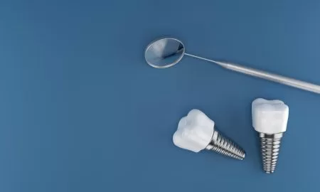 <strong>Implantacja z odroczonym obciążeniem – sprawdzony standard leczenia implantologicznego</strong>